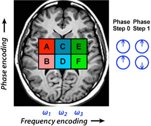 phase and frequency encoding