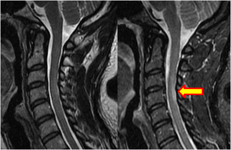 stir-questions-and-answers-in-mri