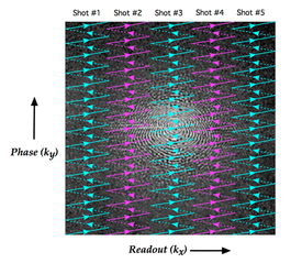 readout segmented DWI RESOLVE