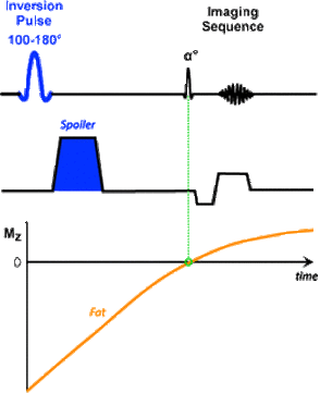 Spectral Presaturation with  Inversion Recovery (SPIR)