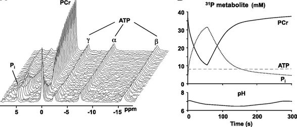 Dynamic 31P muscle spectra