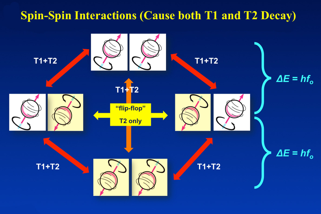 spin-spin-questions-and-answers-in-mri