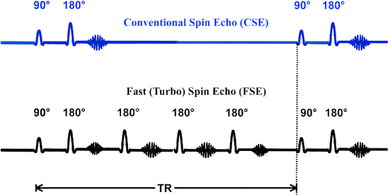 Fast SE/Turbo SE